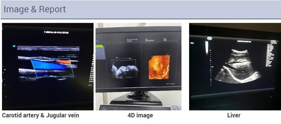 2D 3D 4D 초음파심장검진법 심장 손수레 반향 컬러 도플러 초음파 기계