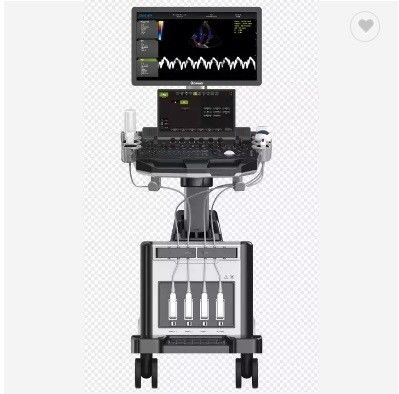 2D 3D 4D 초음파심장검진법 심장 손수레 반향 컬러 도플러 초음파 기계