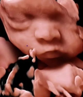 OB GYN을 위한 3D 4D 5D 컬러 도플러 초음파 손수레 초음파 스캐너